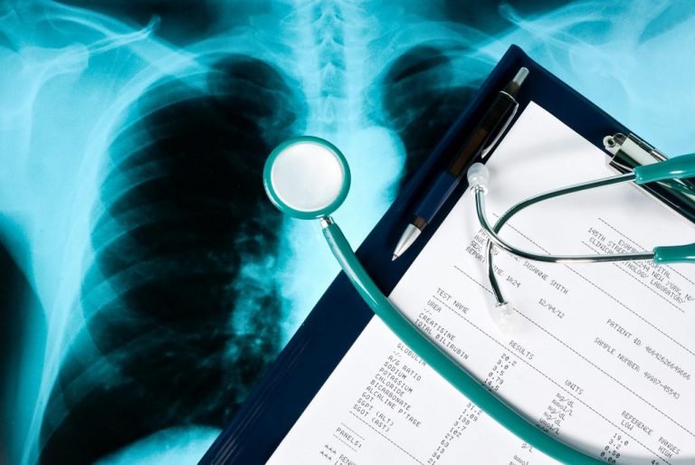 Medical Misdiagnosis Compensation Claims Medical Negligence Law UK