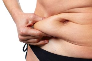 Botched liposuction claims guide